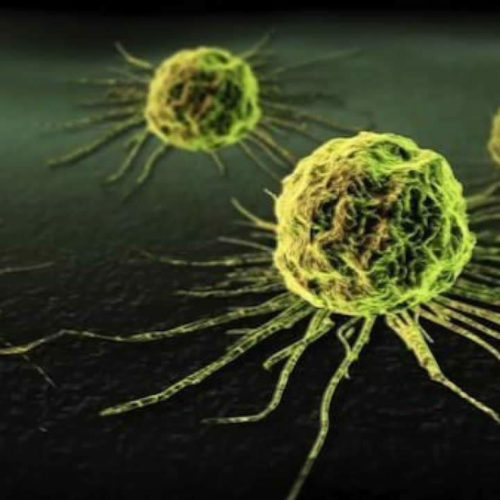 comment sa fait on un cancer